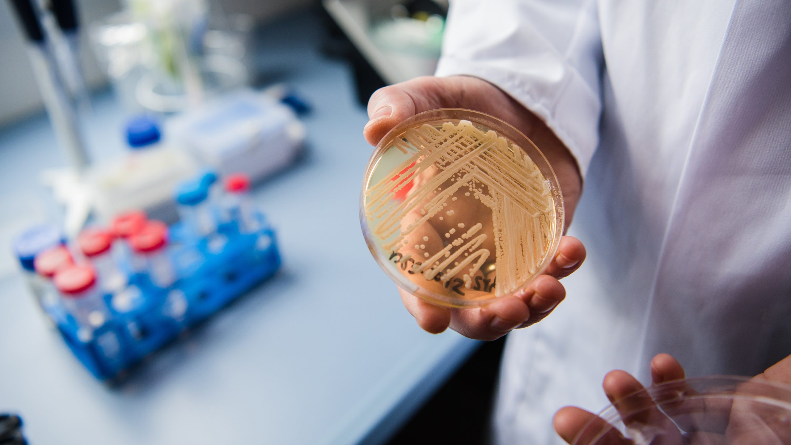New study reveals why dangerous fungus is so difficult to treat — KTVU FOX 2 Bay Area, Saratoga Community news